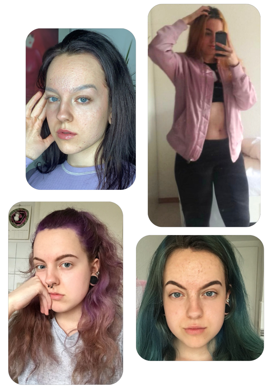 8 Bilder vorher Mailin